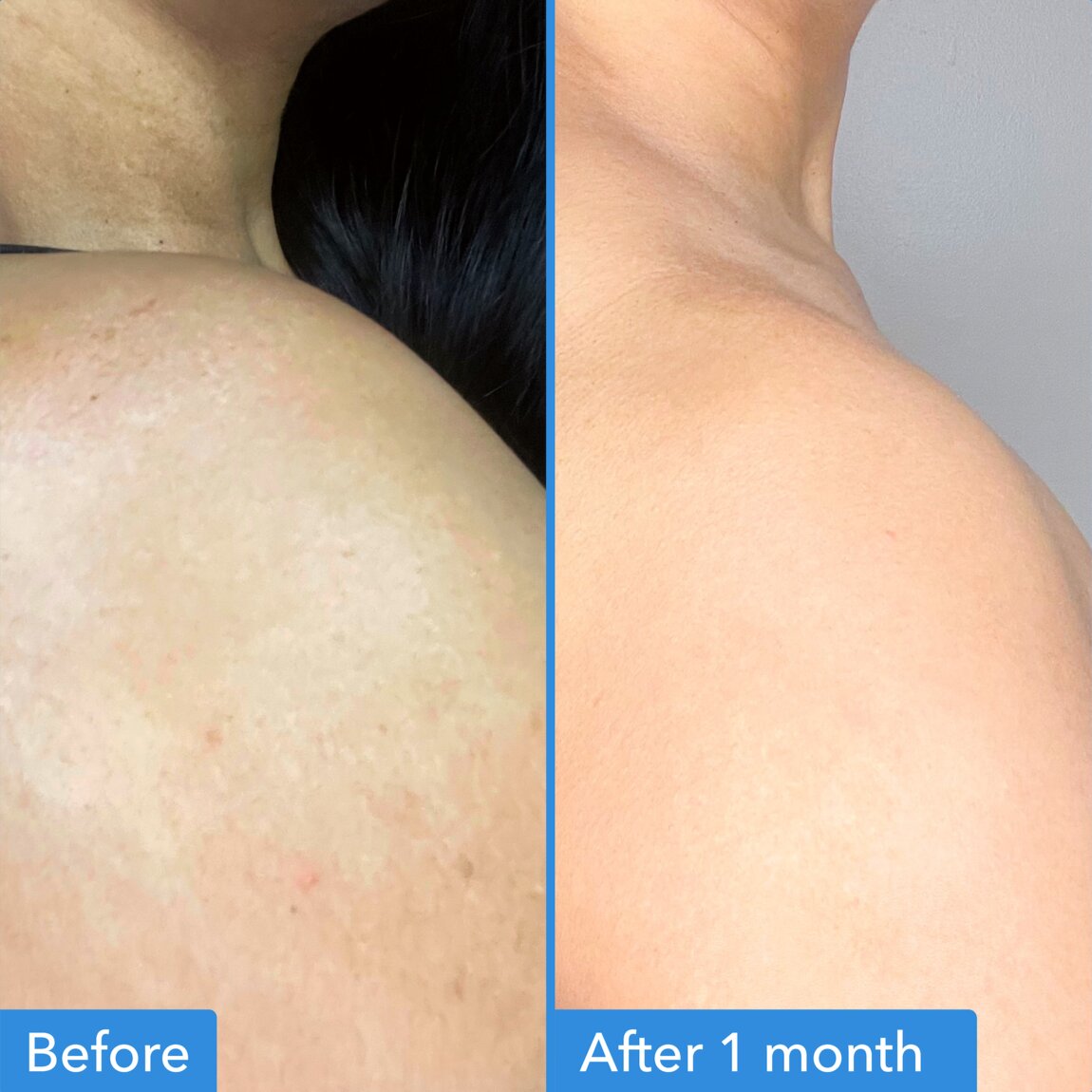 discoloration-correcting-body-treatment-d8 zb_p.jpg