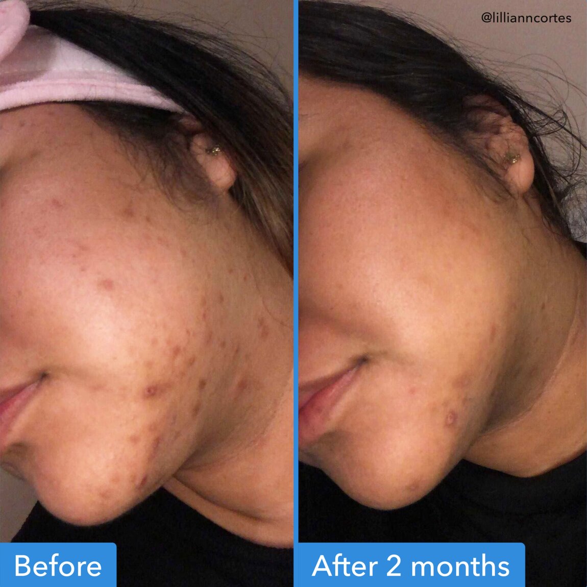 discoloration-correcting-serum-m7 zb_p.jpg
