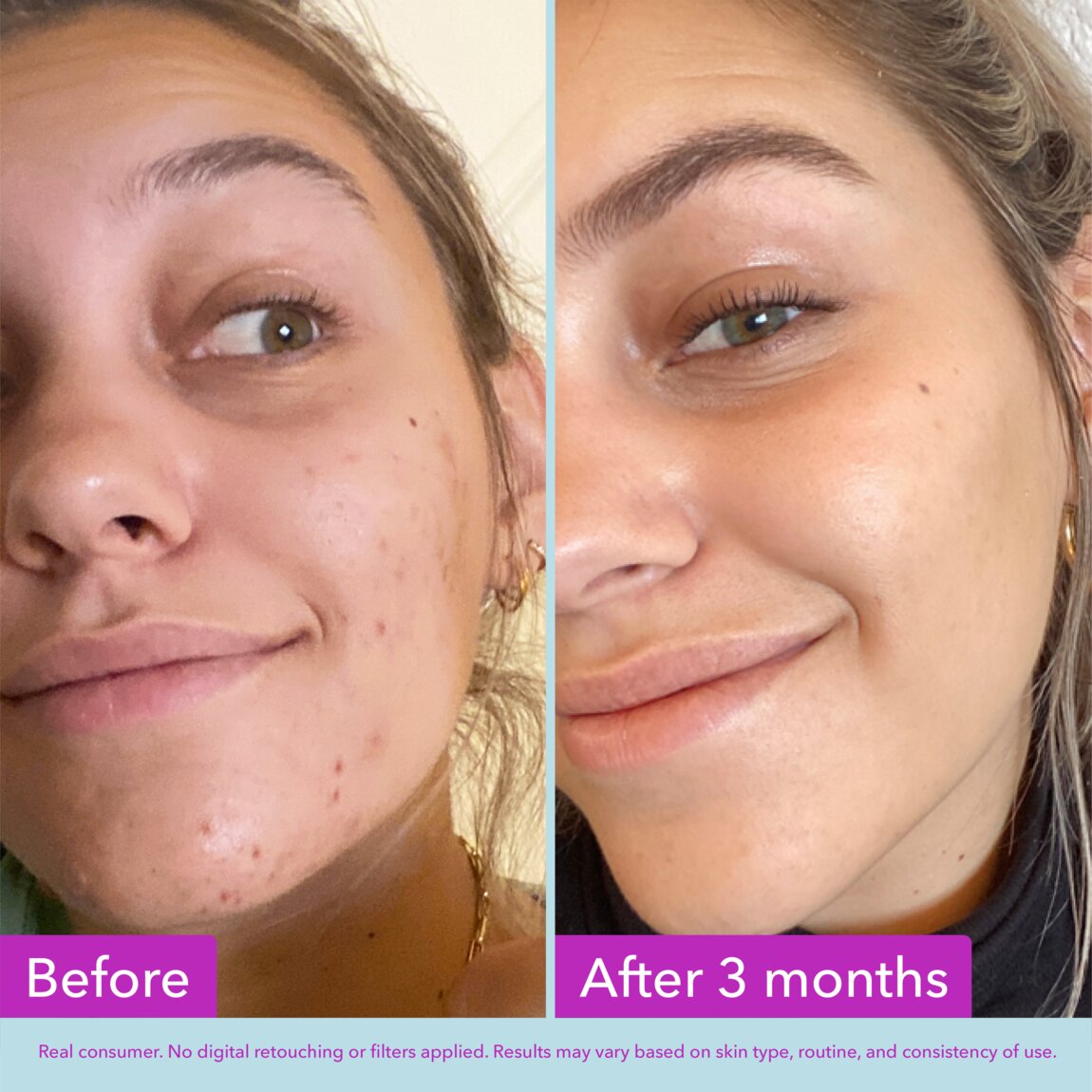 niacinamide-brightening-toner-y2 zb_p.jpg